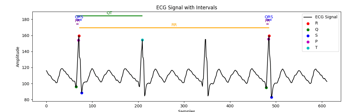 Intelligent Cardiac Signal Analysis